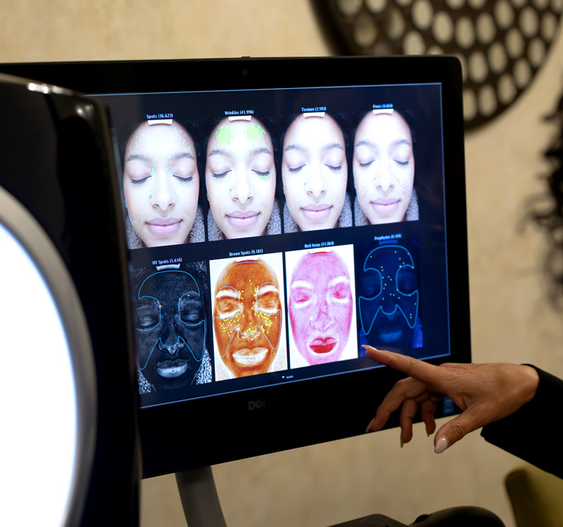 Computer screen showing different layers of skin after skin analysis
